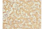 Immunohistochemistry of paraffin-embedded human liver tissue using CSB-PA861986DSR2HU at dilution 1:100