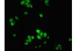 Immunofluorescent analysis of MCF-7 cells using CSB-PA861988LA01HU at a dilution of 1:100 and Alexa Fluor 488-congugated AffiniPure Goat Anti-Rabbit IgG(H+L)