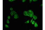 Immunofluorescent analysis of HepG2 cells using CSB-PA862035LA01HU at a dilution of 1:100 and Alexa Fluor 488-congugated AffiniPure Goat Anti-Rabbit IgG(H+L)