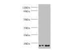 Western blot<br />
All lanes:Gem-associated protein 7 antibody at 2ug/ml<br />
Lane 1: Hela whole cell lysate<br />
Lane 2: 293T whole cell lysate<br />
Secondary<br />
Goat polyclonal to Rabbit IgG at 1/10000 dilution<br />
Predicted band size: 15kDa<br 