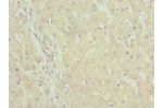 Immunohistochemistry of paraffin-embedded human liver tissue using CSB-PA862042ESR2HU at dilution 1:100