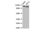 Western Blot<br />
Positive WB detected in:A549 whole cell lysate,Hela whole cell lysate<br />
All lanes:EML4 antibody at 3