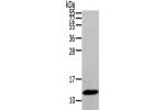 Gel: 8%SDS-PAGE,Lysate: 40 
