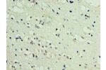 Immunohistochemistry of paraffin-embedded human brain tissue using CSB-PA863102HA01HU at dilution 1:100