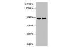 Western blot<br />
All lanes: AARSD1 antibody at 0.8ug/ml<br />
Lane 1 : Hela whole cell lysate<br />
Lane 2 : U251 whole cell lysate<br />
Secondary<br />
Goat polyclonal to Rabbit IgG at 1/10000 dilution<br />
Predicted band size: 46,59,66 kDa<br />
Obs