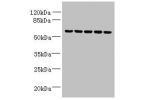 Western blot<br />
All lanes: ADAT1 antibody at 6ug/ml<br />
Lane 1 : Mouse kidney tissue<br />
Lane 2 : Thp-1 whole cell lysate<br />
Lane 3 : Mouse liver tissue<br />
Lane 4 : MDA-MB-231 whole cell lysate<br />
Lane 5 : HL60 whole cell lysate<br />
Seco