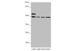 Western blot<br />
All lanes:AP1M1 antibody at 1.43 ug/ml<br />
Lane 1 : A375 whole cell lysate<br />
Lane 2 : Jurkat whole cell lysate<br />
Lane 3 : Hela whole cell lysate<br />
Lane 4 : HepG-2 whole cell lysate<br />
Secondary<br />
Goat polyclonal to 