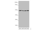 Western blot<br />
All lanes:AP1M1 antibody at 1.38 ug/ml<br />
Lane 1 : A375 whole cell lysate<br />
Lane 2 : Jurkat whole cell lysate<br />
Lane 3 : Hela whole cell lysate<br />
Lane 4 : HepG-2 whole cell lysate<br />
Secondary<br />
Goat polyclonal to 