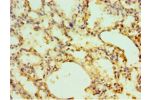 Immunohistochemistry of paraffin-embedded human lung using CSB-PA863932ESR1HUat dilution 1:100