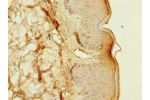 Immunohistochemistry of paraffin-embedded human skin tissue using CSB-PA863943LA01HU at dilution of 1:100