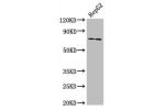 Western Blot<br />
Positive WB detected in:HepG2 whole cell lysate<br />
All lanes:ABCG5 antibody at 8.7