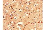 Immunohistochemistry of paraffin-embedded human brain tissue using CSB-PA863978LA01HU at dilution of 1:100