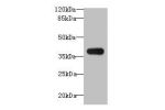 Western blot<br />
All lanes: ASB7 antibody at 8ug/ml+A431 whole cell lysate<br />
Goat polyclonal to rabbit at 1/10000 dilution<br />
Predicted band size: 37,31 kDa<br />
Observed band size: 36 kDa<br />