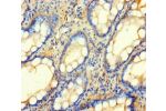 Immunohistochemistry of paraffin-embedded human small intestine tissue using CSB-PA864015LA01HU at dilution of 1:100
