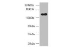 Western blot<br />
All lanes: GDPD2 antibody at 1.5ug/ml+ A431 whole cell lysate<br />
Goat polyclonal to rabbit at 1/10000 dilution<br />
Predicted band size: 62,53,67 kDa<br />
Observed band size: 62 kDa<br />