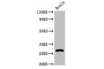 Western Blot<br />
Positive WB detected in:Mouse brain tissue<br />
All lanes:DNAJC4 antibody at 3.2