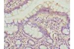 Immunohistochemistry of paraffin-embedded human small intestine tissue using CSB-PA865093HA01HU at dilution of 1:100
