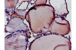 Immunohistochemistry of paraffin-embedded human thyroid tissue using CSB-PA865113LA01HU at dilution of 1:100