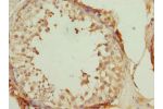 Immunohistochemistry of paraffin-embedded human testis tissue using CSB-PA865123DSR2HU at dilution 1:100