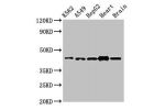 Western Blot<br />
Positive WB detected in:K562 whole cell lysate,A549 whole cell lysate,HepG2 whole cell lysate,Mouse heart tissue,Mouse brain tissue<br />
All lanes:AGPAT3 antibody at 3