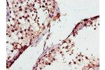 Immunohistochemistry of paraffin-embedded human testis tissue using CSB-PA865134LA01HU at dilution of 1:100