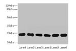 Western blot<br />
All lanes: FKBP14 antibody at 1ug/ml<br />
Lane 1 : Mouse stomach tissue<br />
Lane 2 : Mouse gonadal tissue<br />
Lane 3 : U937 whole cell lysate<br />
Lane 4 : PC-3 whole cell lysate<br />
Lane 5 : 293T whole cell lysate<br />
Lane 6 
