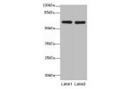 Western blot<br />
All lanes:CNOT2 antibody at 2ug/ml<br />
Lane 1:293T whole cell lysate<br />
Lane 2:Jurkat whole cell lysate<br />
Secondary<br />
Goat polyclonal to rabbit at 1/10000 dilution<br />
Predicted band size: 60,41,23,52,55 kDa<br />
Observe