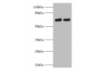 Western blot<br />
All lanes:FLRT1 antibody at 2ug/ml<br />
Lane 1:mouse kidney tissue<br />
Lane 2:Hela whole cell lysate<br />
Secondary<br />
Goat polyclonal to rabbit at 1/10000 dilution<br />
Predicted band size: 71kDa<br />
Observed band size: 71kDa