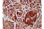 IHC image of CSB-PA866200LA01HU diluted at 1:400 and staining in paraffin-embedded human pancreatic tissue performed on a Leica BondTM system. After dewaxing and hydration, antigen retrieval was mediated by high pressure in a citrate buffer (pH 6.0). Sect