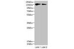 Western blot<br />
All lanes: FYCO1 antibody at 2.5ug/ml<br />
Lane 1 : HepG-2 whole cell lysate<br />
Lane 2 : Mouse liver tissue<br />
Secondary<br />
Goat polyclonal to Rabbit IgG at 1/10000 dilution<br />
Predicted band size: 167,44,169 kDa<br />
Obse