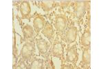 Immunohistochemistry of paraffin-embedded human rectal tissue using CSB-PA866295LA01HU at dilution 1:100