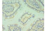 Immunohistochemistry of paraffin-embedded human small intestine using CSB-PA866299ESR2HU at dilution 1:100