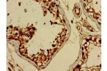 Immunohistochemistry of paraffin-embedded human testis tissue using CSB-PA866300LA01HU at dilution of 1:100