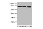Western blot<br />
All lanes: BBS2 antibody at 5.01ug/ml<br />
Lane 1 : Mouse liver tissue<br />
Lane 2 : Mouse brain tissue<br />
Lane 3 : Mouse gonadal tissue<br />
 Goat polyclonal to Rabbit IgG at 1/10000 dilution<br />
Predicted band size: 80 kDa<br 
