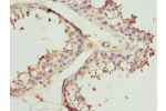 Immunohistochemistry of paraffin-embedded human testis tissue using CSB-PA866303ESR2HU at dilution 1:100