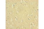 Immunohistochemistry of paraffin-embedded human brain tissue using CSB-PA866311LA01HU at dilution 1:100