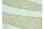 Immunohistochemistry of paraffin-embedded human skeletal muscle using CSB-PA866314ESR1HU at dilution 1:100
