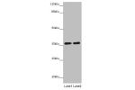 Western blot<br />
All lanes: GNB1L antibody at 3.69 ug/ml<br />
Lane 1 : Mouse brain tissue<br />
Lane 2 : Jurkat whole cell lysate<br />
Secondary<br />
Goat polyclonal to rabbit IgG at 1/10000 dilution<br />
Predicted band size: 36,23 kDa<br />
Observe