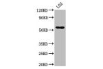 Western Blot<br />
Positive WB detected in:LO2 whole cell lysate<br />
All lanes:AGXT2 antibody at 4.9