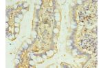 Immunohistochemistry of paraffin-embedded human small intestine tissue using CSB-PA866338LA01HU at dilution of 1:100