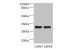 Western blot<br />
All lanes: DRAM2 antibody at 3.84ug/ml<br />
Lane 1 : Mouse heart tissue<br />
Lane 2 : Mouse liver tissue<br />
Secondary<br />
Goat polyclonal to Rabbit IgG at 1/10000 dilution<br />
Predicted band size: 30 kDa<br />
Observed band siz