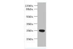 Western blot<br />
All lanes: ENKD1 antibody at 7ug/ml+ Mouse brain tissue<br />
Goat polyclonal to rabbit at 1/10000 dilution<br />
Predicted band size: 39,26 kDa<br />
Observed band size: 27 kDa<br />
