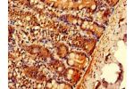 Immunohistochemistry of paraffin-embedded human small intestine tissue using CSB-PA867130LA01HU at dilution of 1:100