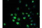 Immunofluorescent analysis of A2780 cells using CSB-PA867134EA01HU at a dilution of 1:100 and Alexa Fluor 488-congugated AffiniPure Goat Anti-Rabbit IgG(H+L)