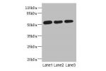 Western blot<br />
All lanes: ARMT1 antibody at 0.6ug/ml<br />
Lane 1 : MCF7 whole cell lysate<br />
Lane 2 : A431 whole cell lysate<br />
Lane 3 : 293T whole cell lysate<br />
Secondary<br />
Goat polyclonal to Rabbit IgG at 1/10000 dilution<br />
Predic