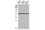 Western blot analysis of mouse-lung mouse-heart mouse-liver lysis using EDA antibody. Antibody was diluted at 1:1000. Secondary antibody  was diluted at 1:20000