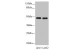 Western blot<br />
All lanes: GCM1antibody at 0.97ug/ml<br />
Lane 1 : Hela whole cell lysate<br />
Lane 2 : HepG-2 whole cell lysate<br />
Secondary<br />
Goat polyclonal to Rabbit IgG at 1/10000 dilution<br />
Predicted band size: 49 kDa<br />
Observed 