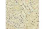 Immunohistochemistry of paraffin-embedded human kidney tissue using CSB-PA868276ESR1HU at dilution of 1:100