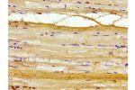 Immunohistochemistry of paraffin-embedded human skeletal muscle tissue using CSB-PA868282LA01HU at dilution of 1:100