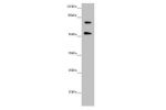 Western blot<br />
All lanes:ABCB8 antibody at 2.02 ug/ml<br />
 + Mouse heart tissue<br />
Secondary<br />
Goat polyclonal to rabbit IgG at 1/10000 dilution<br />
Predicted band size: 80,79,76,69,60 kDa<br />
Observed band size: 80,55 kDa<br />